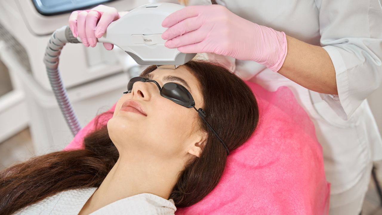 Young woman undergoing intense pulsed light therapy